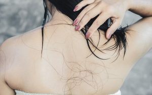 【医師コメントつき】「びまん性脱毛症」の症状・原因・対処法